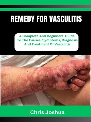cover image of REMEDY FOR VASCULITIS